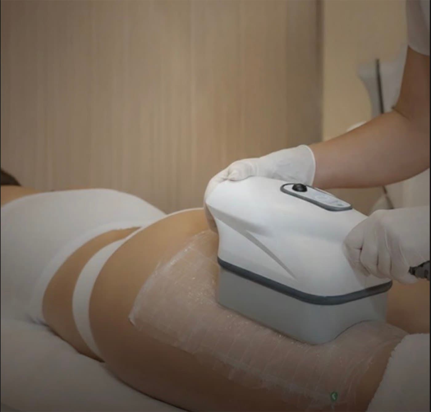 Criolipoliză și remodelare corporală la XPilates & Spa